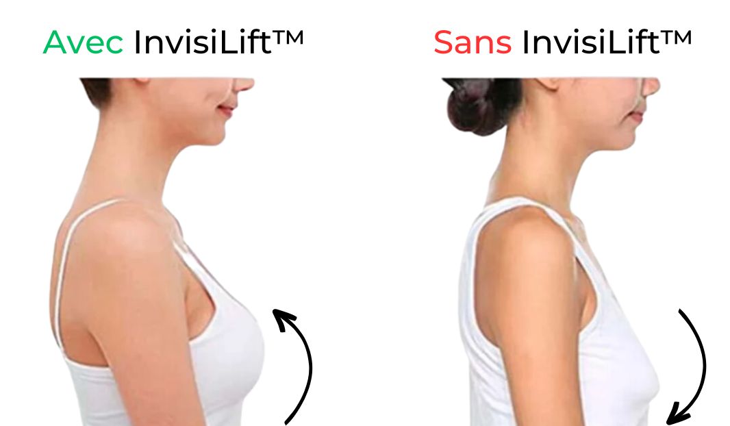 InvisiLift™